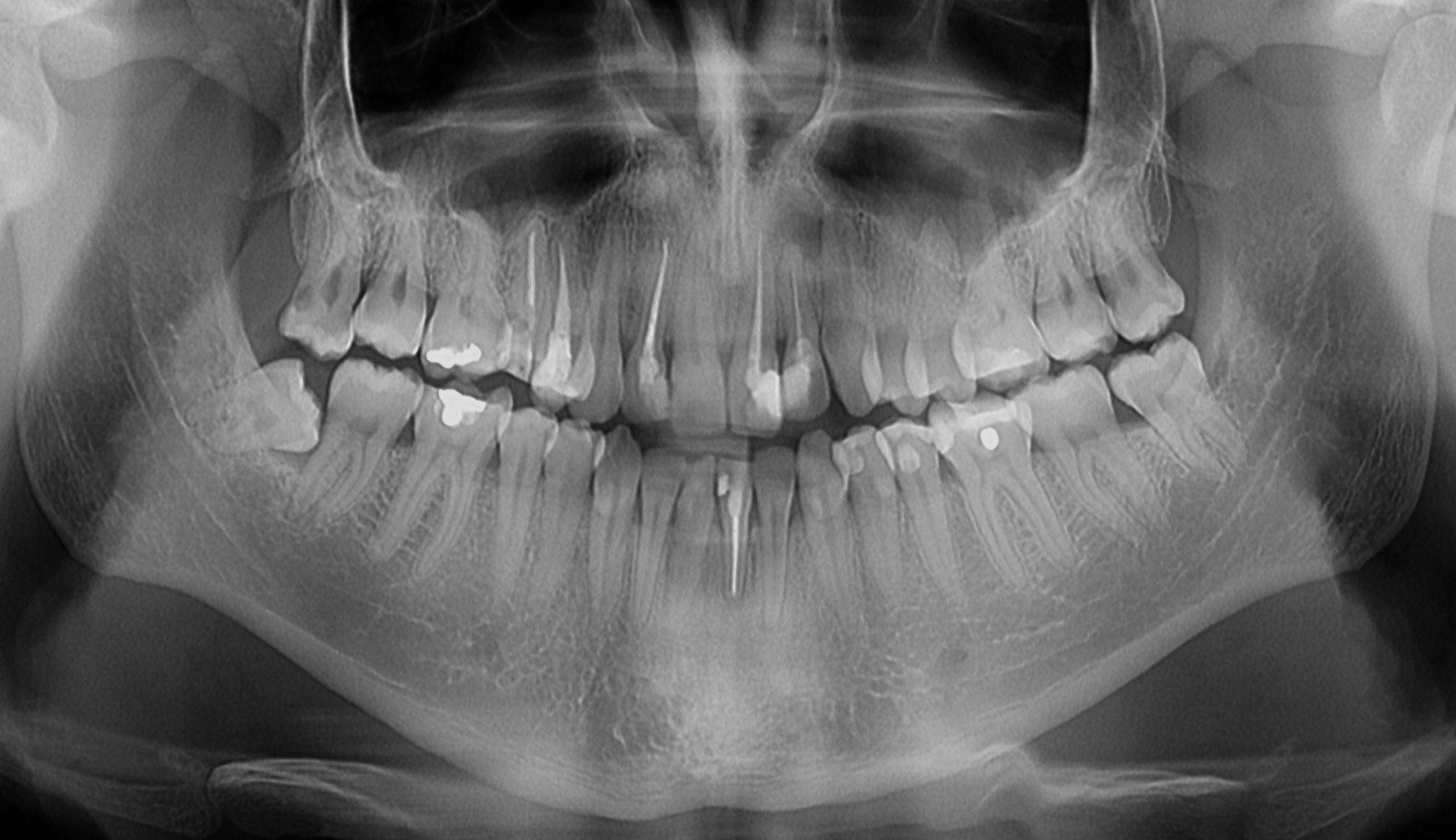 3d snimanje zuba ortopan