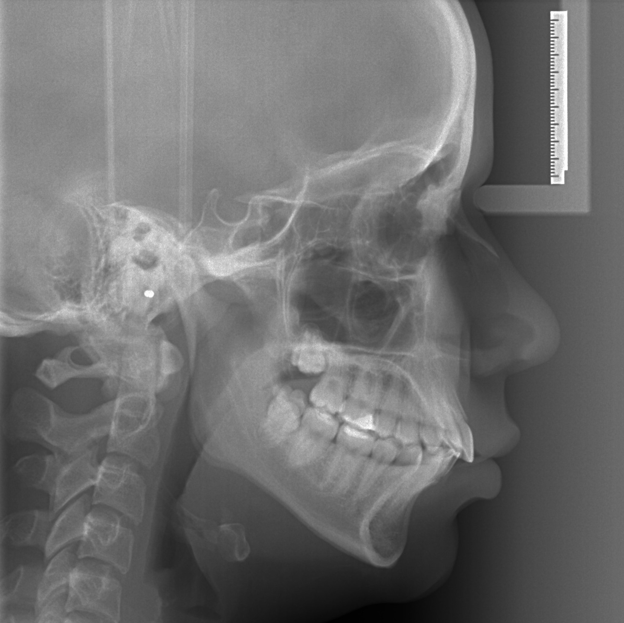 3d snimanje zuba telerendgen