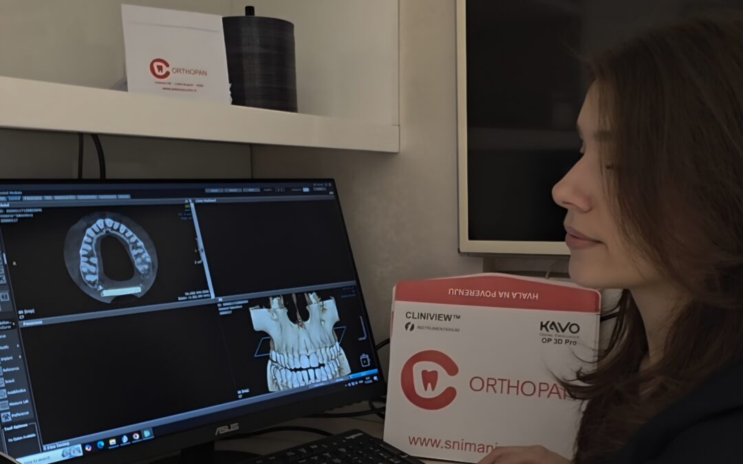 3D snimanje zuba – detaljan vodič: šta je 3d snimanje zuba, kako izgleda i kada je potrebno?